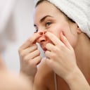 El acné y los puntos negros se generan con mayor frecuencia en pieles grasas.