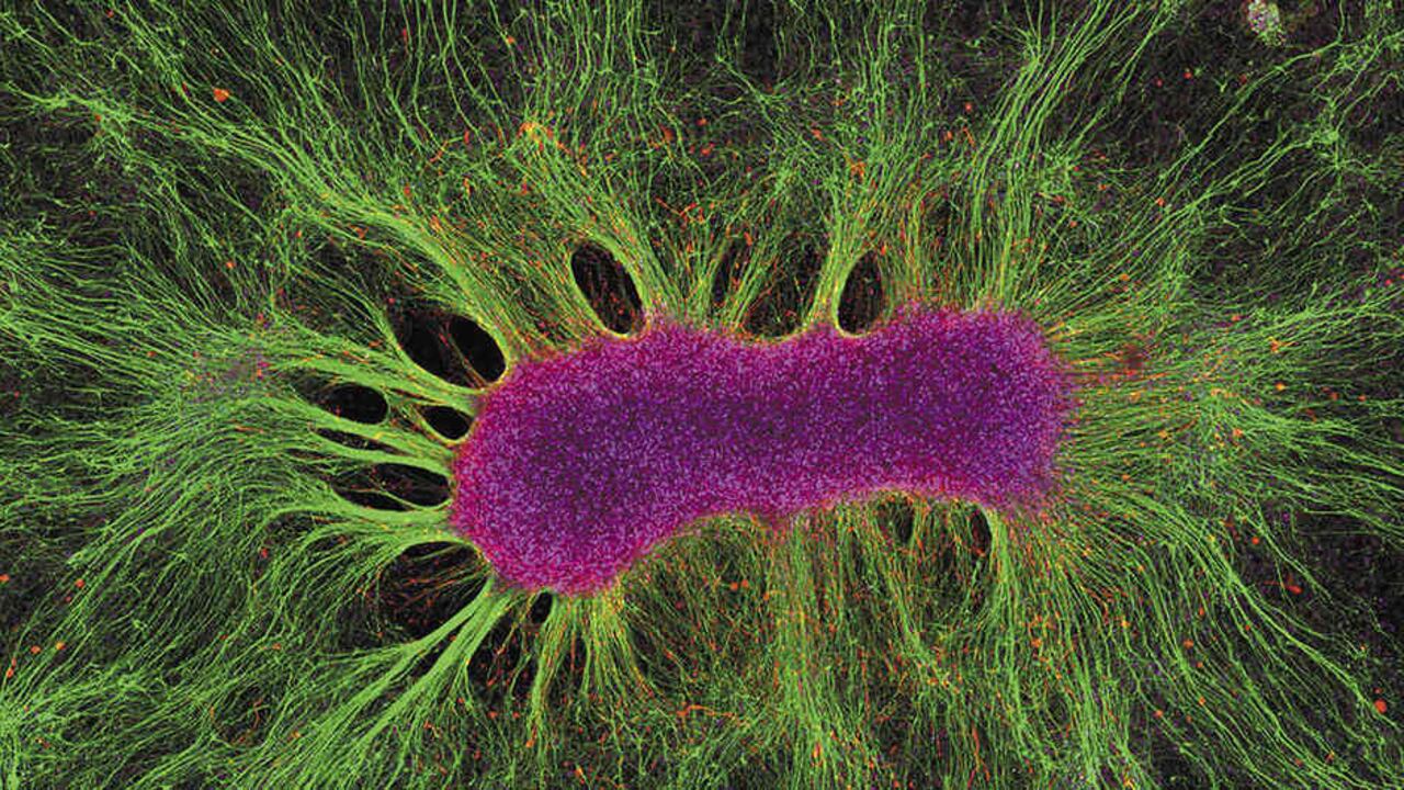 Así se ve desde un microscopio un organoide cerebral. Este es creado, entre otras cosas, para investigar enfermedades neurológicas humanas.