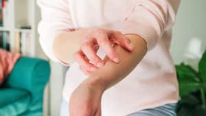 Alergia a algunos alimentos.