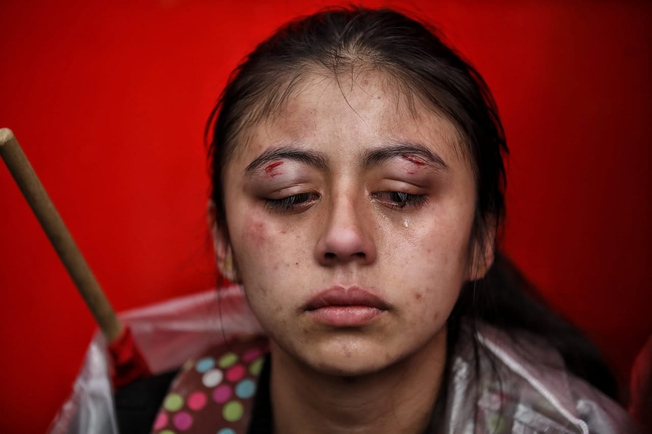 Paula Baez, manifestante herida en las protestas