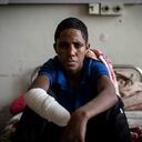 Haftom Gebretsadik, un joven de 17 años de Freweini, Etiopía, cerca de Hawzen, a quien le amputaron la mano derecha y perdió los dedos de la izquierda después de que una bala de artillería golpeara su casa en marzo, se sienta en su cama en el Hospital de Referencia Ayder en Mekele , en la región de Tigray, en el norte de Etiopía, el jueves 6 de mayo de 2021. “Estoy muy preocupado”, dijo. "¿Cómo puedo trabajar?" (Foto AP / Ben Curtis)