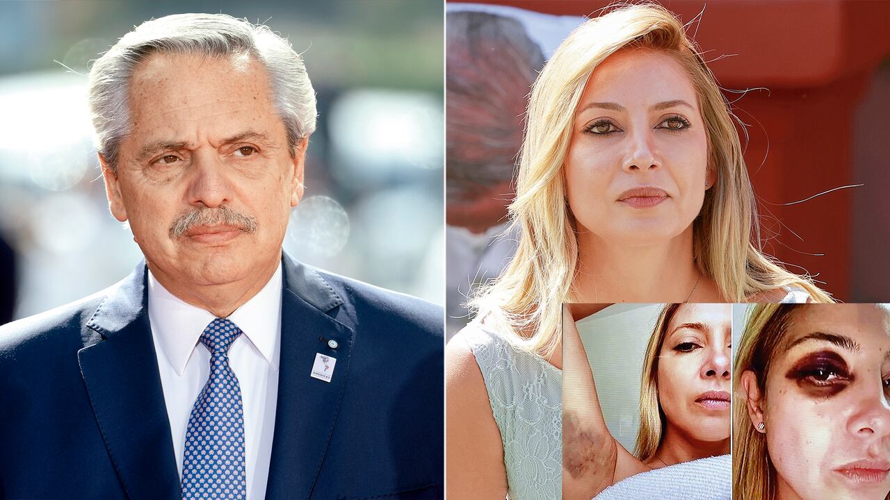 Alberto Fernández podría ser sentenciado como mínimo a dos años de prisión por cuenta de las acusaciones de su expareja.