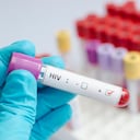 Blood sample positive with HI