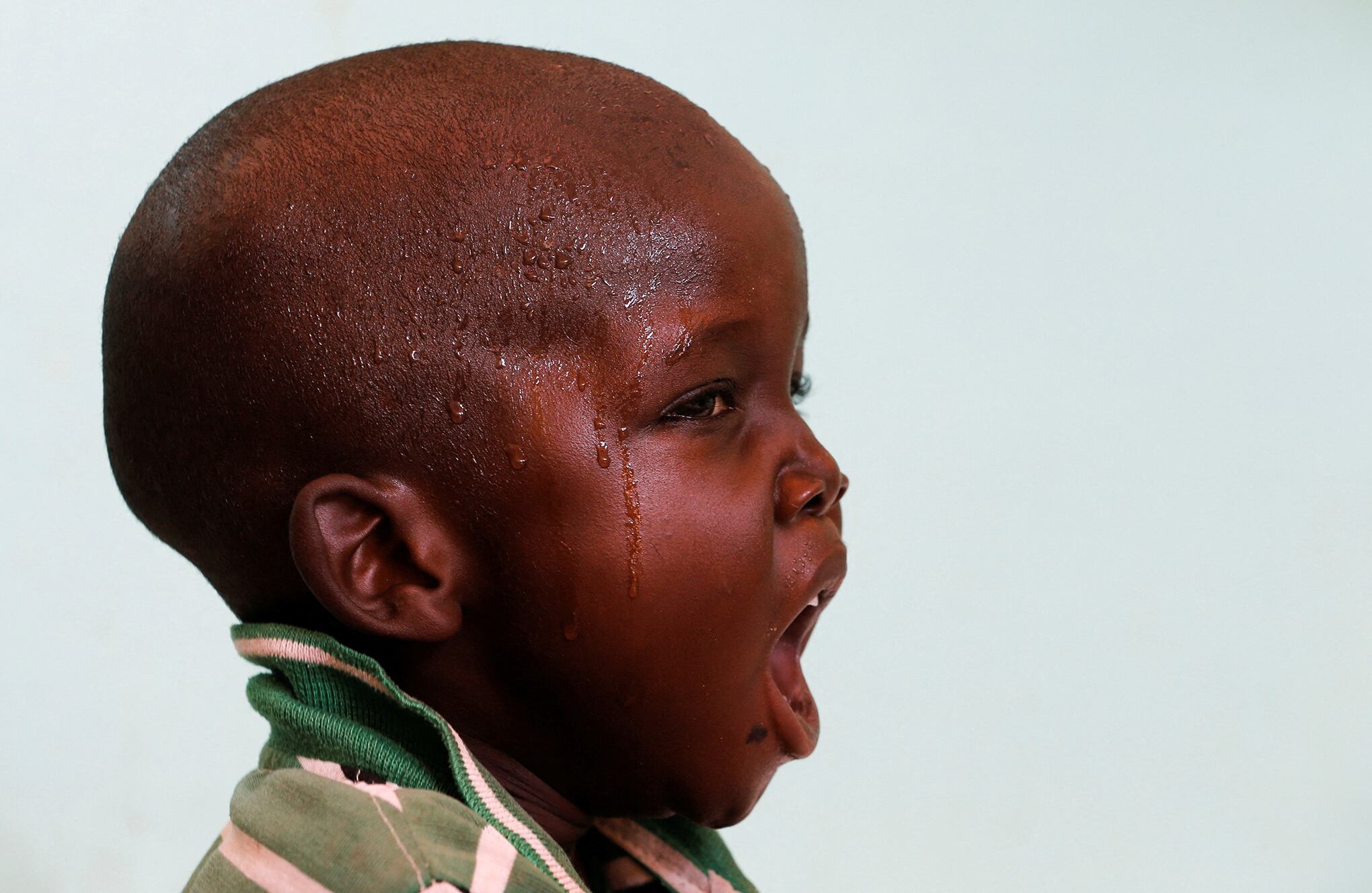 En imágenes : Kenia enfrenta una crisis de hambre mientras la sequía acaba con el ganado