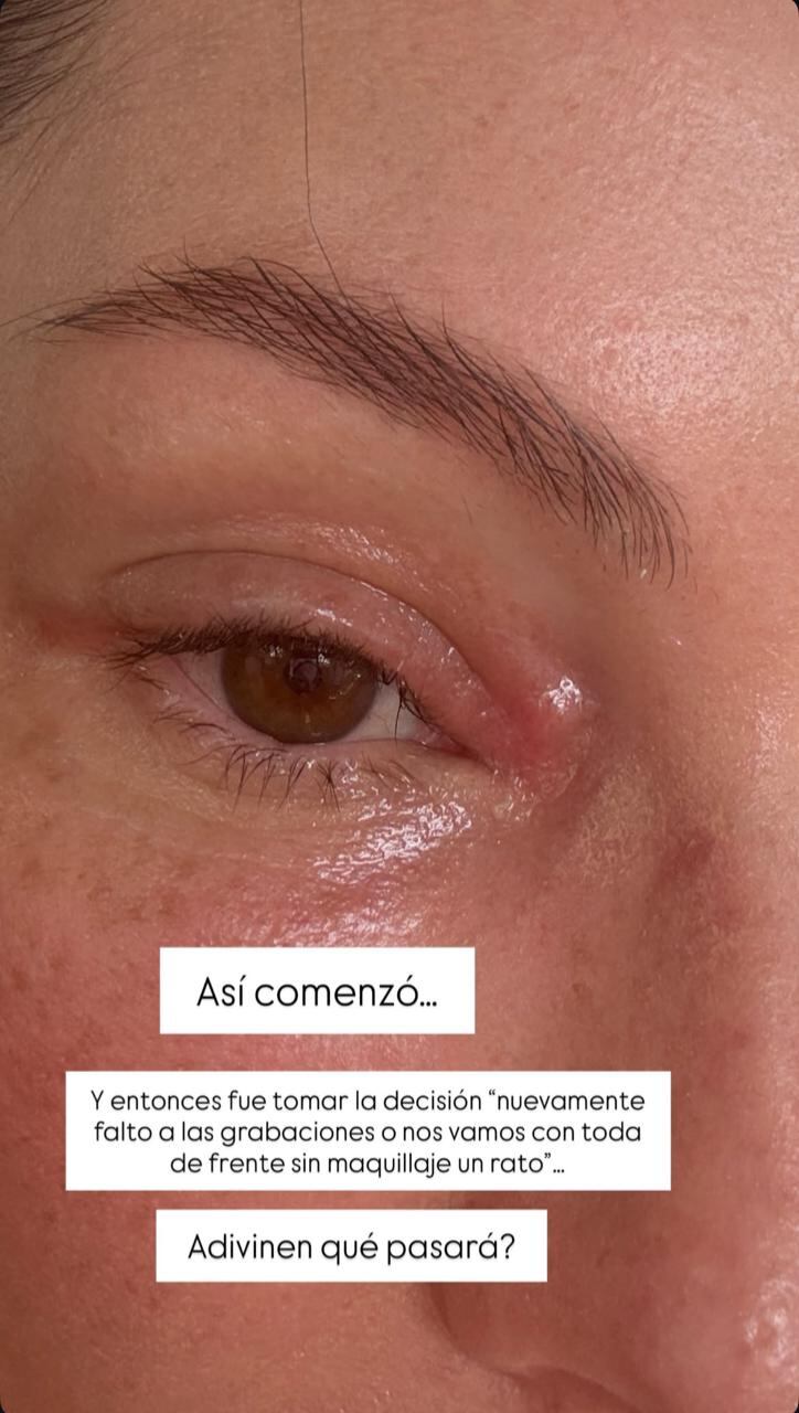 Claudia Bahamón dejó a la vista tema de salud que la afectó.