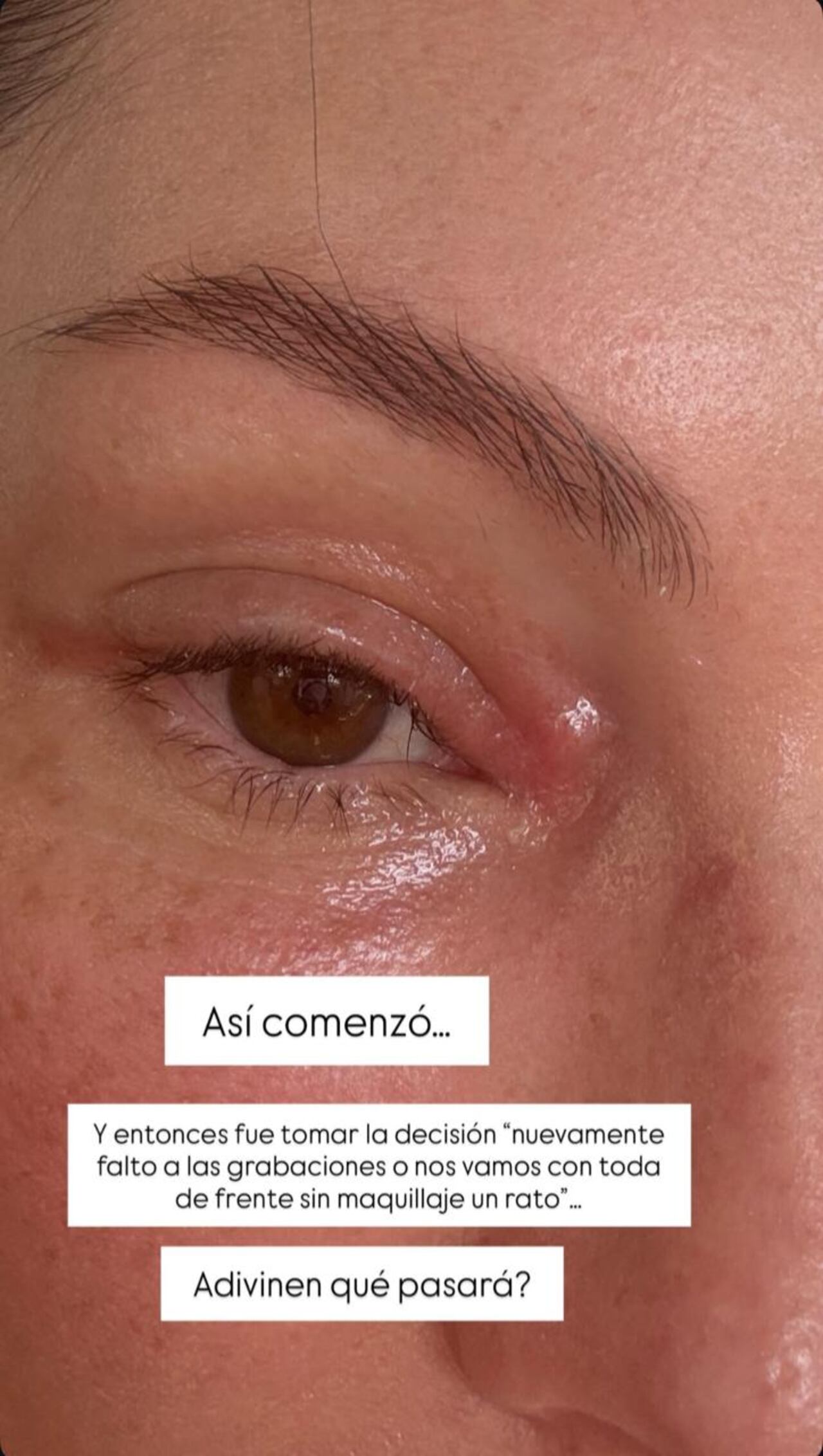 Claudia Bahamón dejó a la vista tema de salud que la afectó.