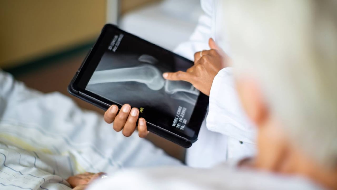 Expertos indican que los dolores en las articulaciones en deportistas se pueden solucionar con suplementos y alimentación sana, para no dejar la actividad física. Foto: Getty images.