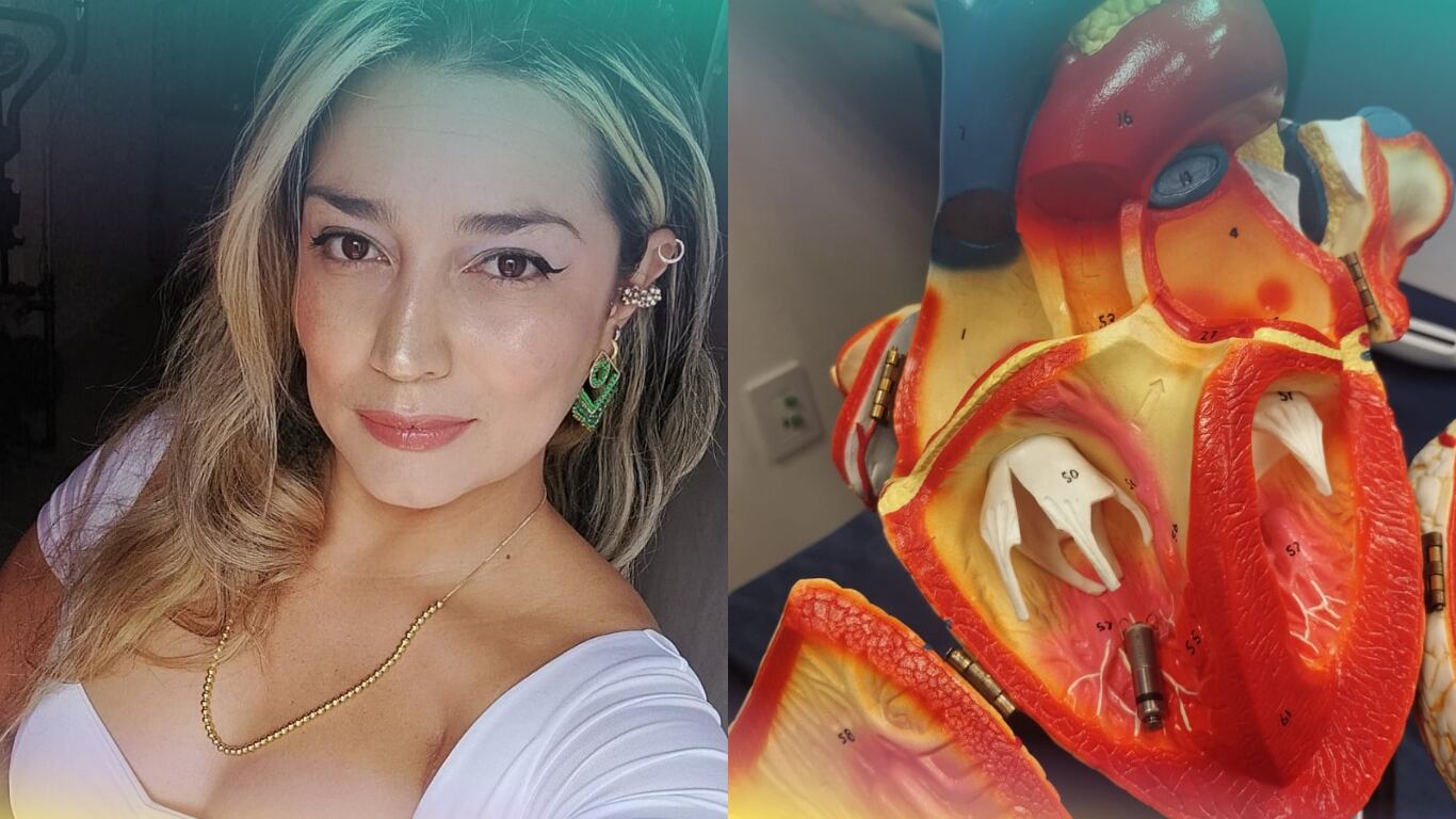 Carolina Taborda le contó a SEMANA cómo fue vivir con siete marcapasos, los momentos de angustia y las afectaciones en su cuerpo a causa de estos dispositivos.