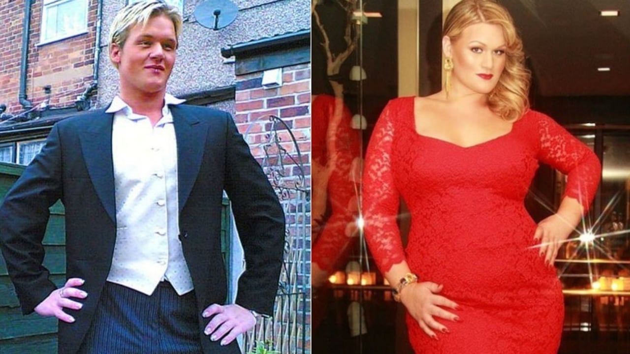 Chelsea Attonley, antes (izquierda) y después (derecha) de operarse y recibir tratamiento hormonal.