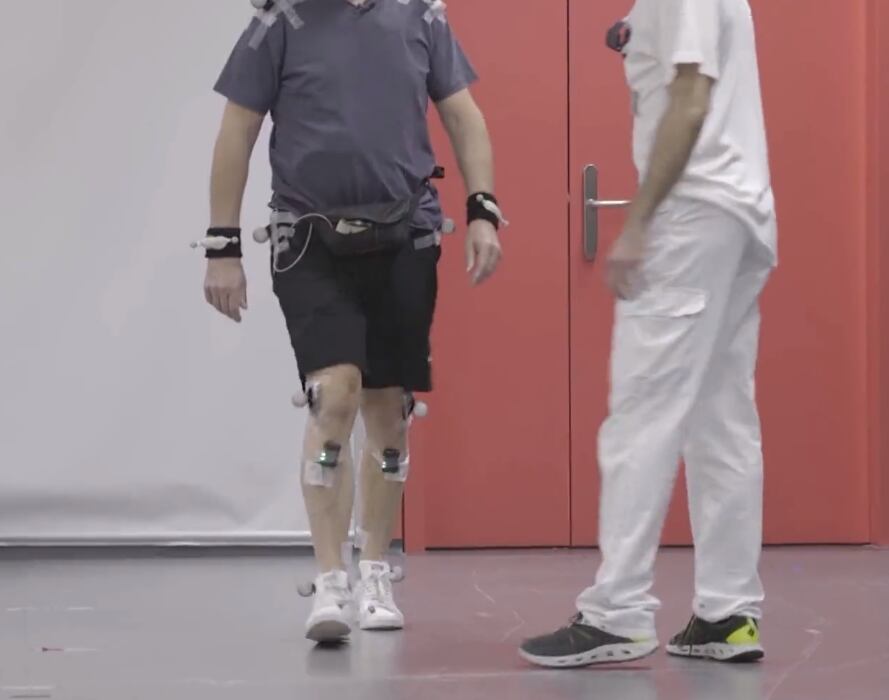 Las terapias recibidas le han permitido volver a realizar movimientos que antes no podía.