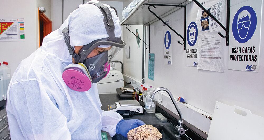 Se va a comenzar una terapia experimental en personas sanas para evitar la enfermedad y llegar a una cura. 