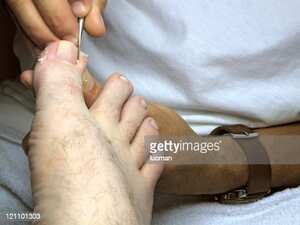 Si se desea se puede consultar con un podólogo.