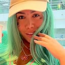 Yina está inmóvil en su casa de cuenta de los biopolímeros. Foto: Instagram @yinaacalderonoficial.