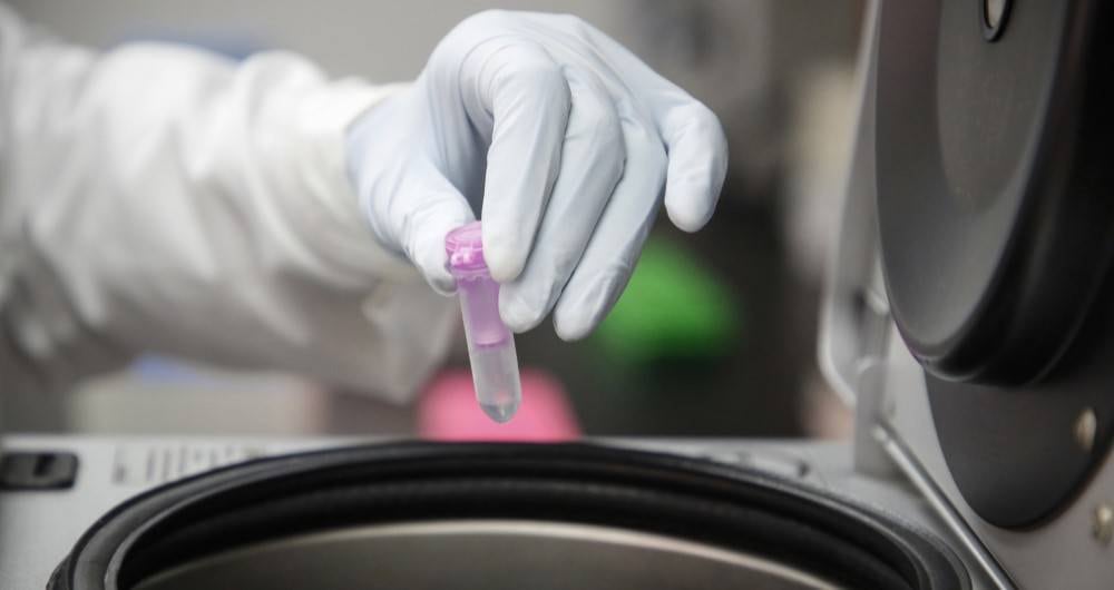 Se trata de 39 mil muestras PCR tomadas entre el 2 de septiembre y el 12 de octubre del año 2021, estas muestras fueron analizadas por un laboratorio privado ubicado en Wolverhapton. 