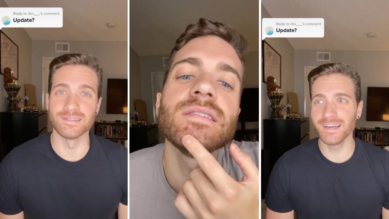 El actor estadounidense Matt Ford contó su experiencia tras contagiarse de la viruela del mono.