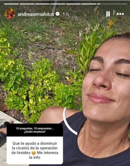 Andrea Serna habló de la cicatriz que tiene y cómo le da manejo