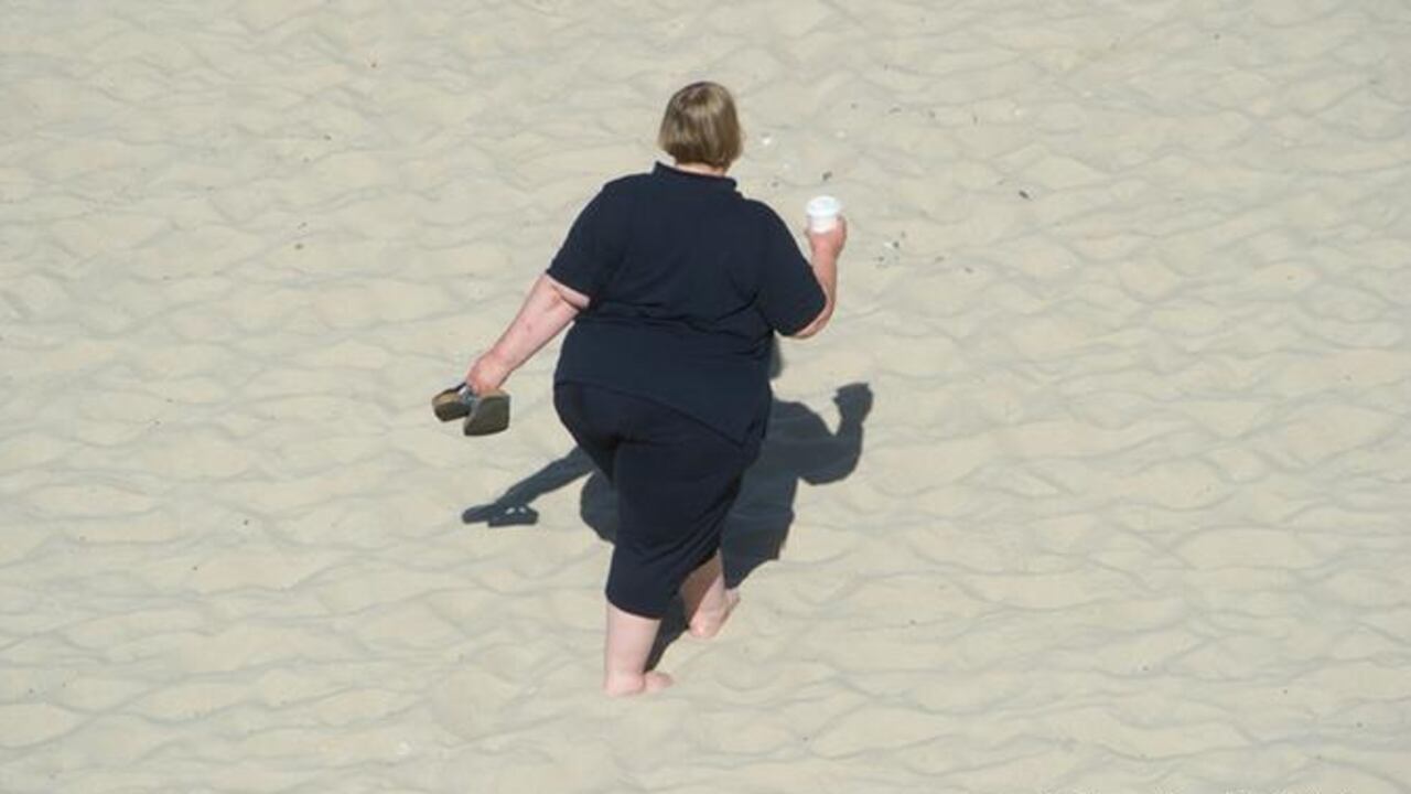 Obesidad DW - NO USAR