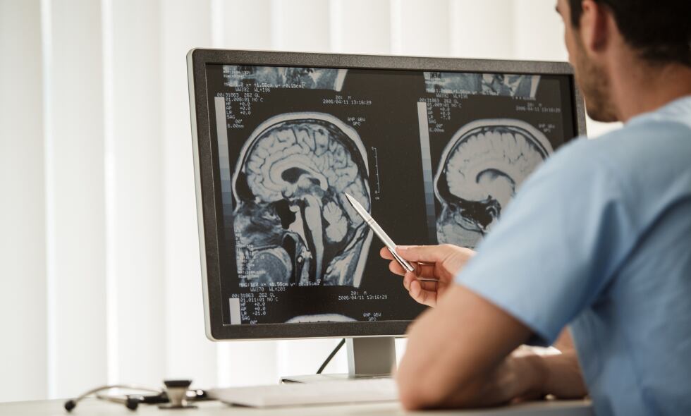 El estudio Indigo ha sentado las bases para una nueva era en el tratamiento de los gliomas de grado bajo al proporcionar evidencia sólida de la eficacia del vorasidenib, despertando la esperanza de una vida más larga y de mejor calidad para los pacientes.