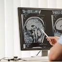 El estudio Indigo ha sentado las bases para una nueva era en el tratamiento de los gliomas de grado bajo al proporcionar evidencia sólida de la eficacia del vorasidenib, despertando la esperanza de una vida más larga y de mejor calidad para los pacientes.