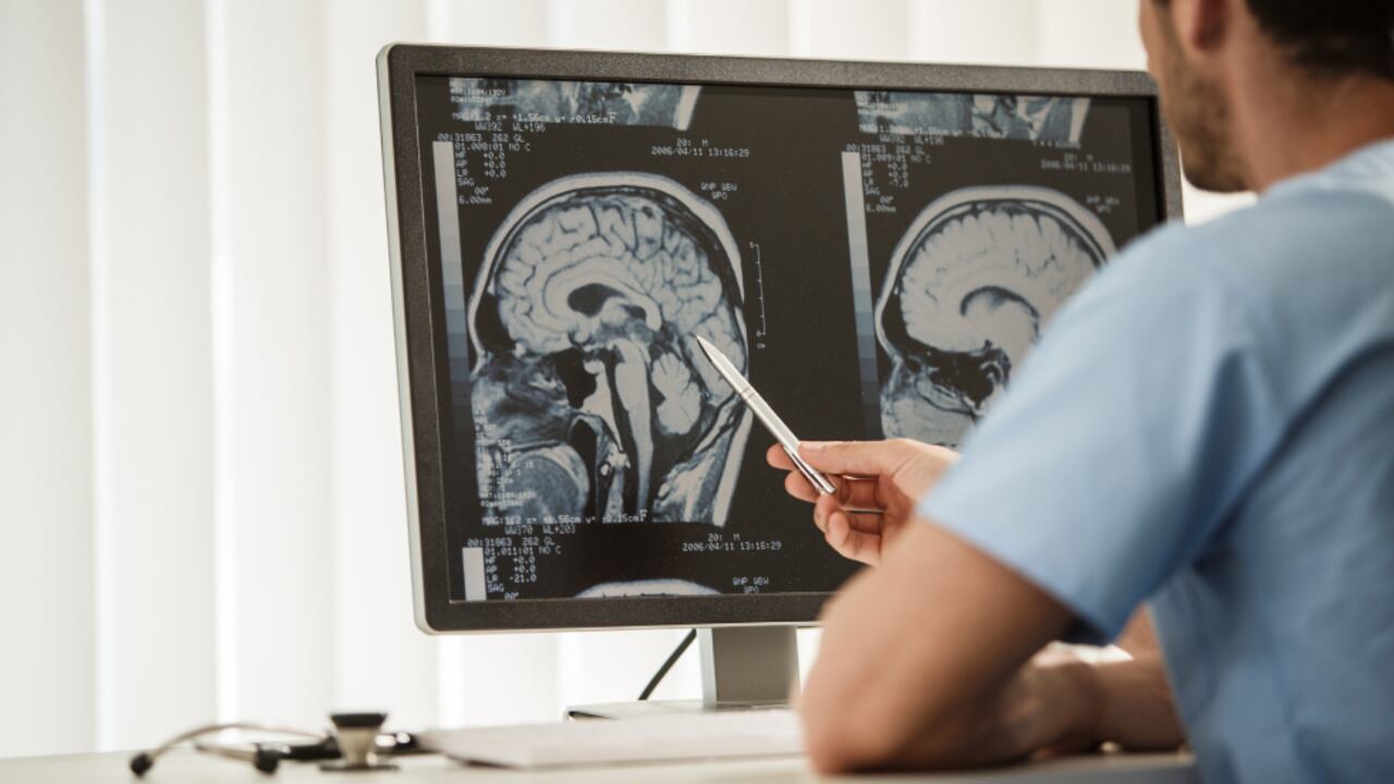 Existen más de 100 tipos de tumores cerebrales.