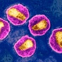 Imagen microscópica del VIH.