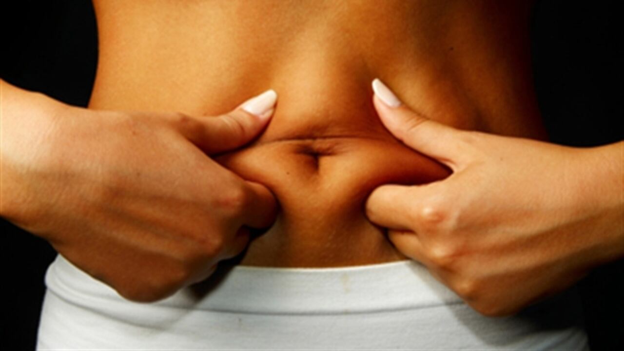 La flacidez abdominal es el exceso de piel en el abdomen. (Foto: Thinkstock )
