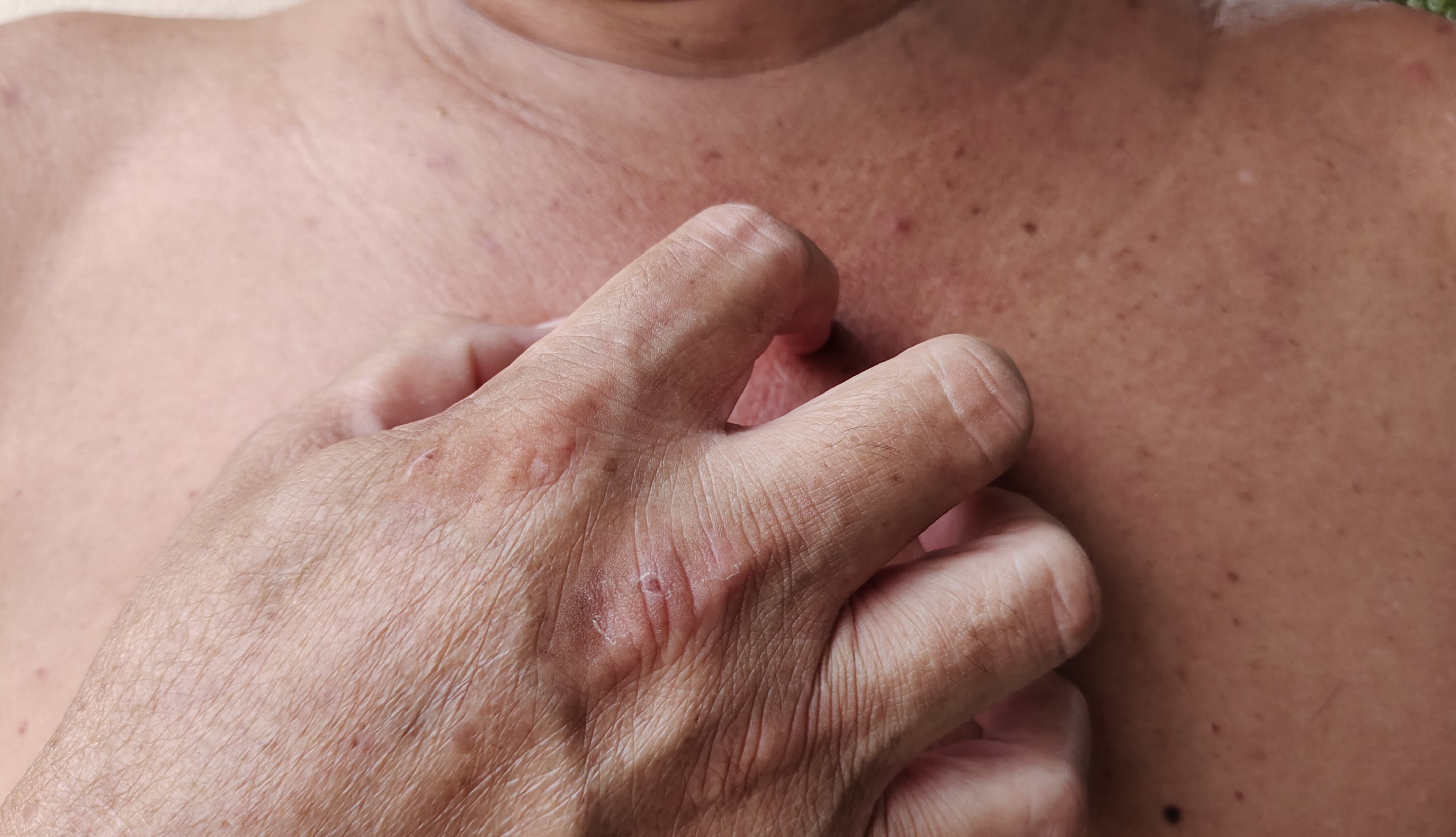 El  cuello puede estar negro porque falta de higiene.