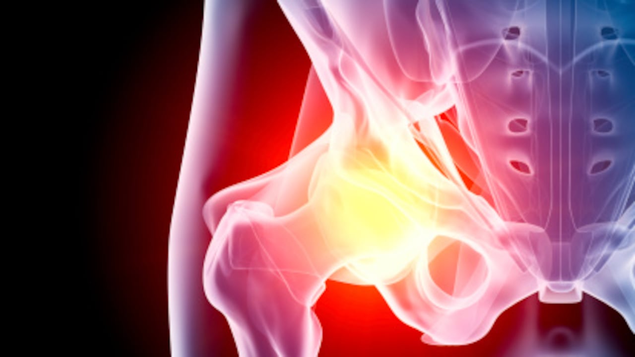 La actividad física es importante para evitar lesiones y caídas.