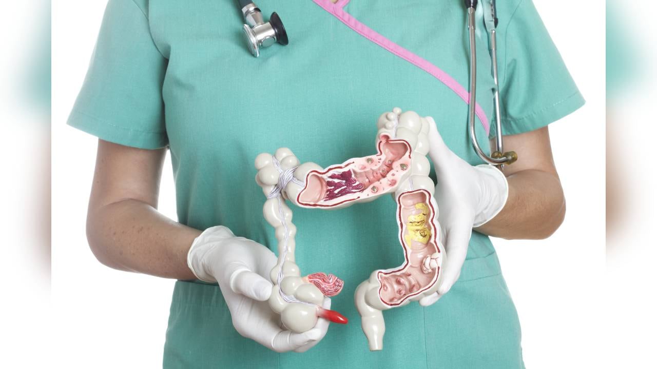 Una de las funciones del colon es la absorción de agua y sodio para el equilibrio de los electrolitos. Foto: GettyImages.