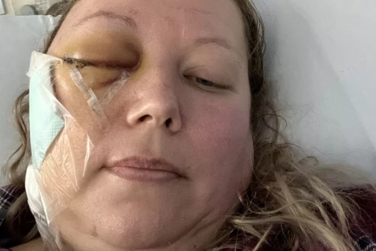 La mujer recibió el devastador diagnóstico después de ir al oftalmólogo.