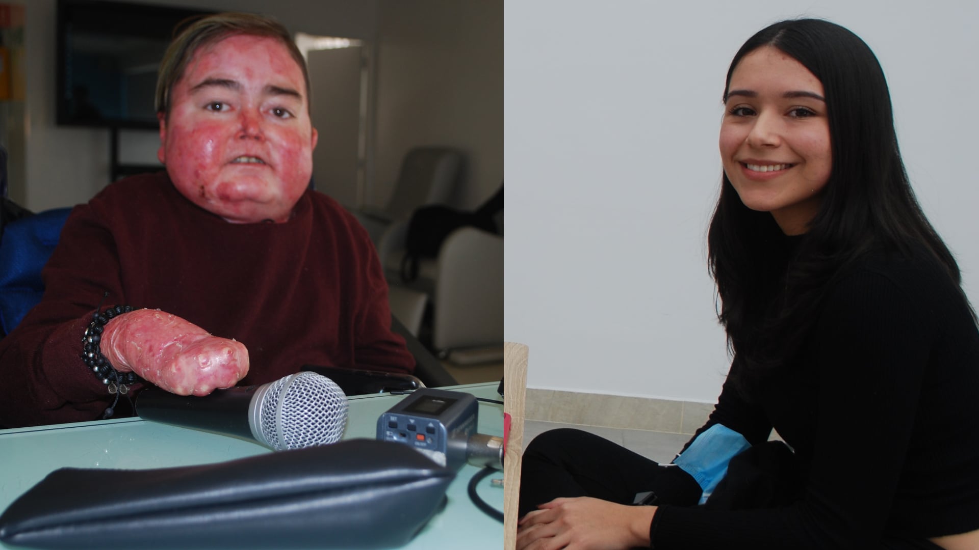 Pacientes con Piel  de Mariposa.
Santiago Vargas y Valery Ramírez