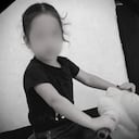 La menor sufría de epilepsias, tenía autismo y no podía hablar.