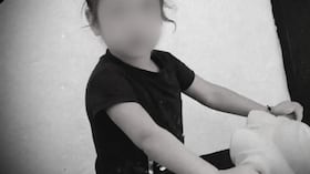 La menor sufría de epilepsias, tenía autismo y no podía hablar.