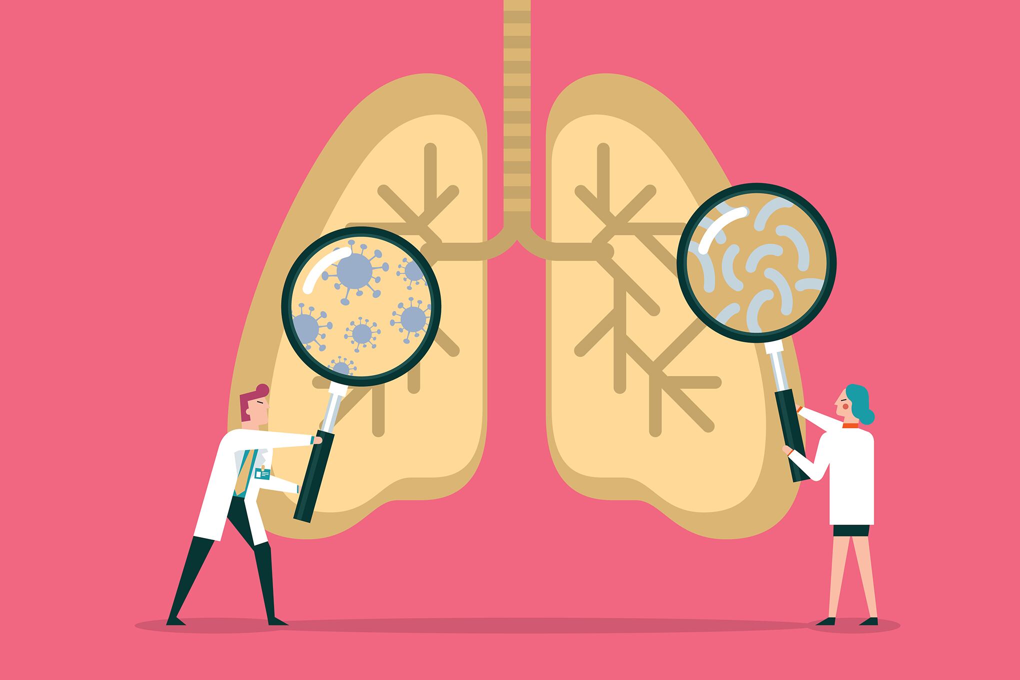 Equipo de médicos diagnostican pulmones humanos