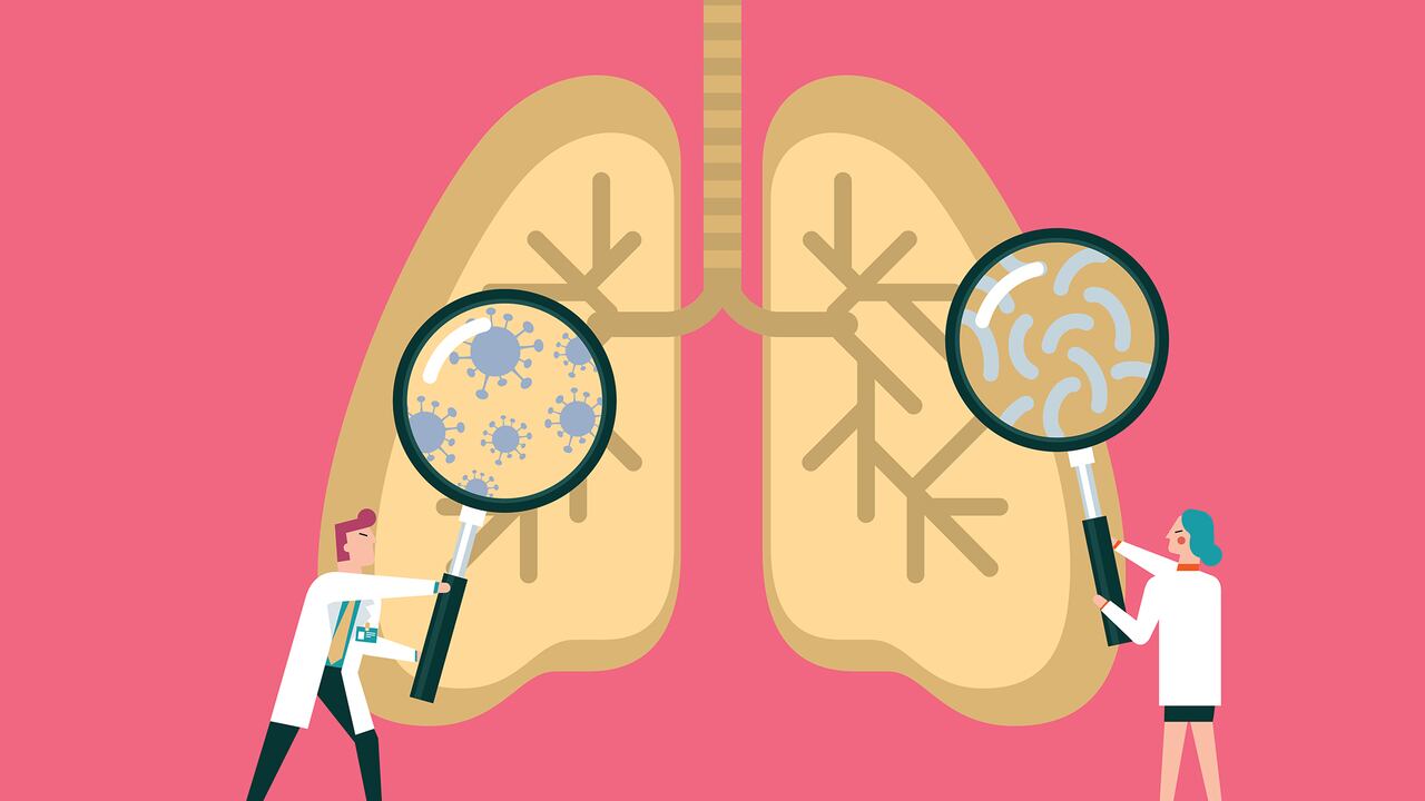 Equipo de médicos diagnostican pulmones humanos