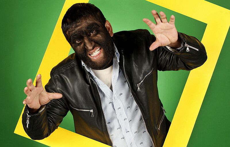 Como sacado de una leyenda, en México vive el "Hombre Lobo". Jesús Fajardo tiene hipertricosis, que hoy lo tiene con la cara poblada de vello. 