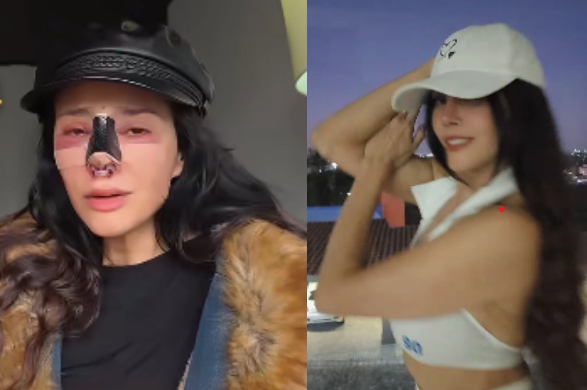 Actriz tuvo cirugía estética fallida y se le desfiguró el rostro.