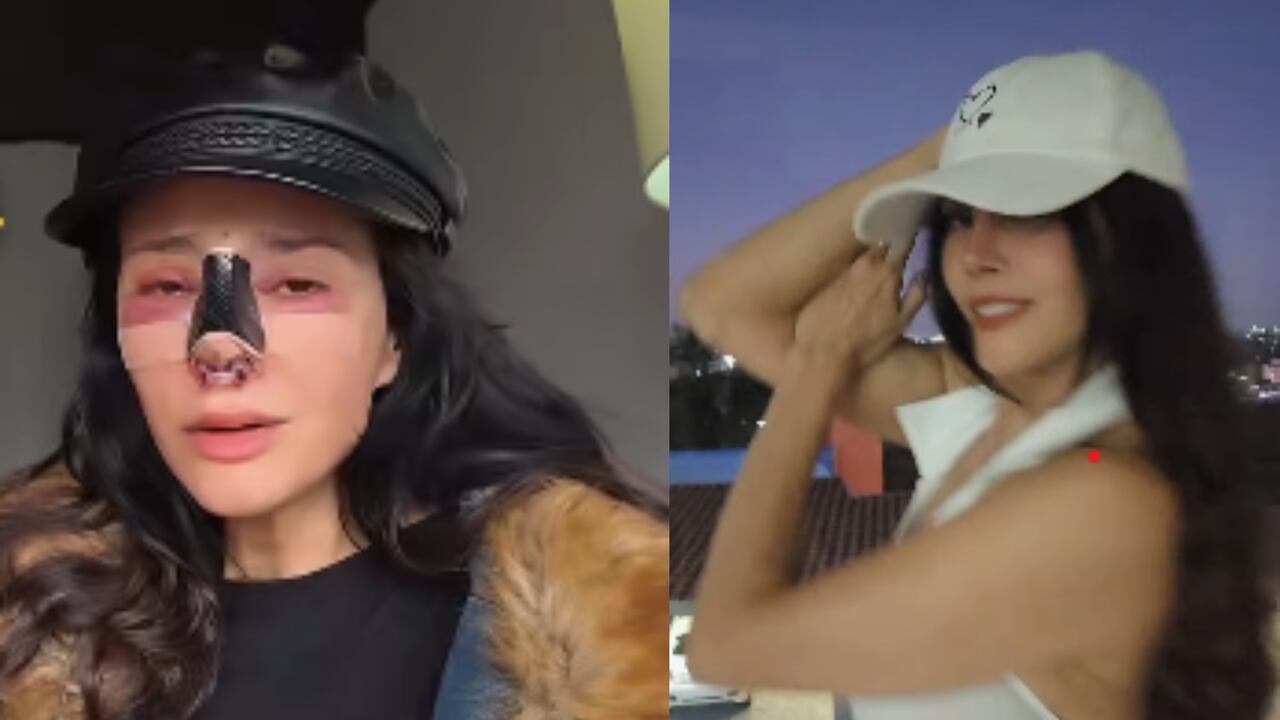 Actriz tuvo cirugía estética fallida y se le desfiguró el rostro.