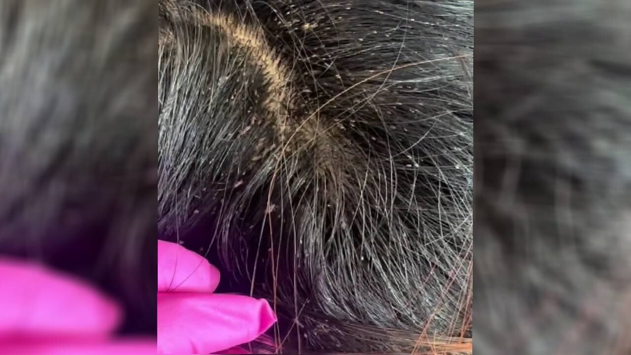 La niña llevaba años con ese padecimiento, según medios internacionales.