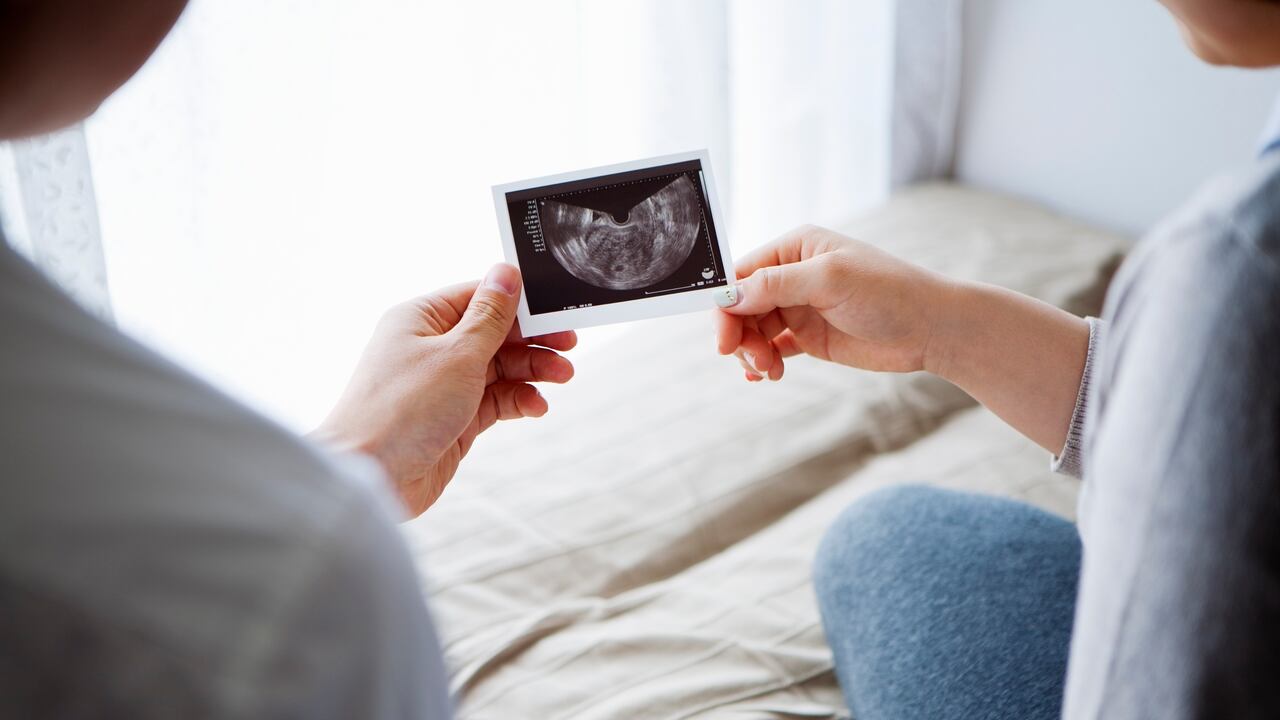 El sobrepeso, la exposición a rayos X, entre otros factores, pueden afectar la fertilidad de un hombre.