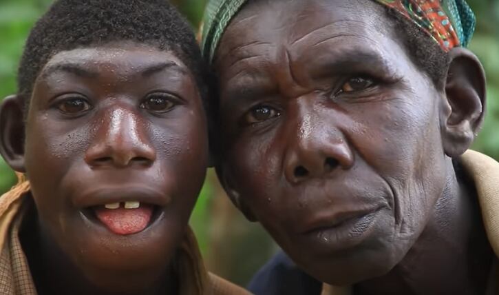 El joven ha sufrido de burlas y rechazo debido a su apariencia física.