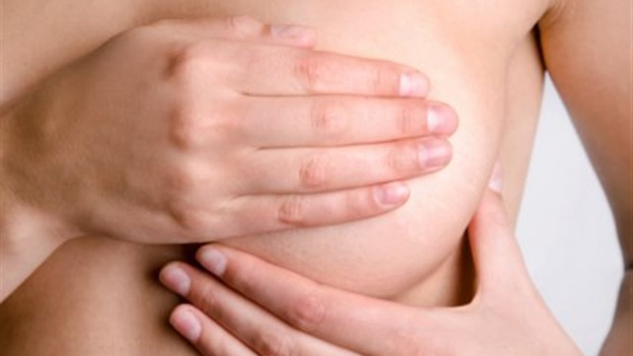 El cáncer de mama es el tipo de cáncer más común. Foto: Thinkstock