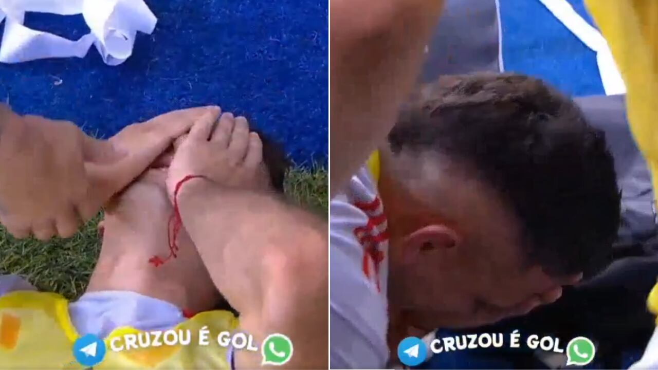 Rafael Santos Borré fue golpeado en juego con Inte de Porto Alegre