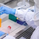 Investigadores de la Universidad de Antioquia aislaron el virus que genera la viruela del mono.