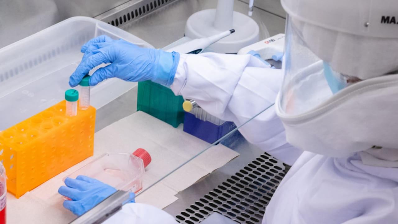 La capital caldense confirma su primer caso de viruela del mono