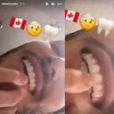 El artista señala que el diente se le 'chitió' tras el golpe auto infringido.