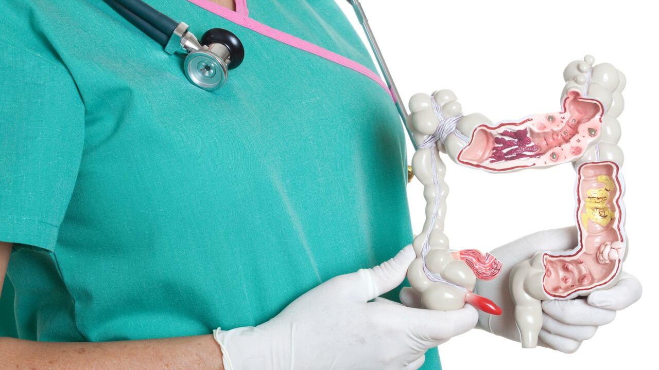 Colon: ¿Cómo eliminar heces acumuladas?