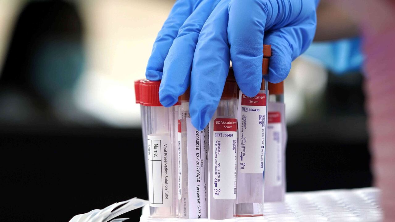 Coronavirus hoy: La Unión Europea autoriza venta de remdesivir contra covid-19/Foto: AP