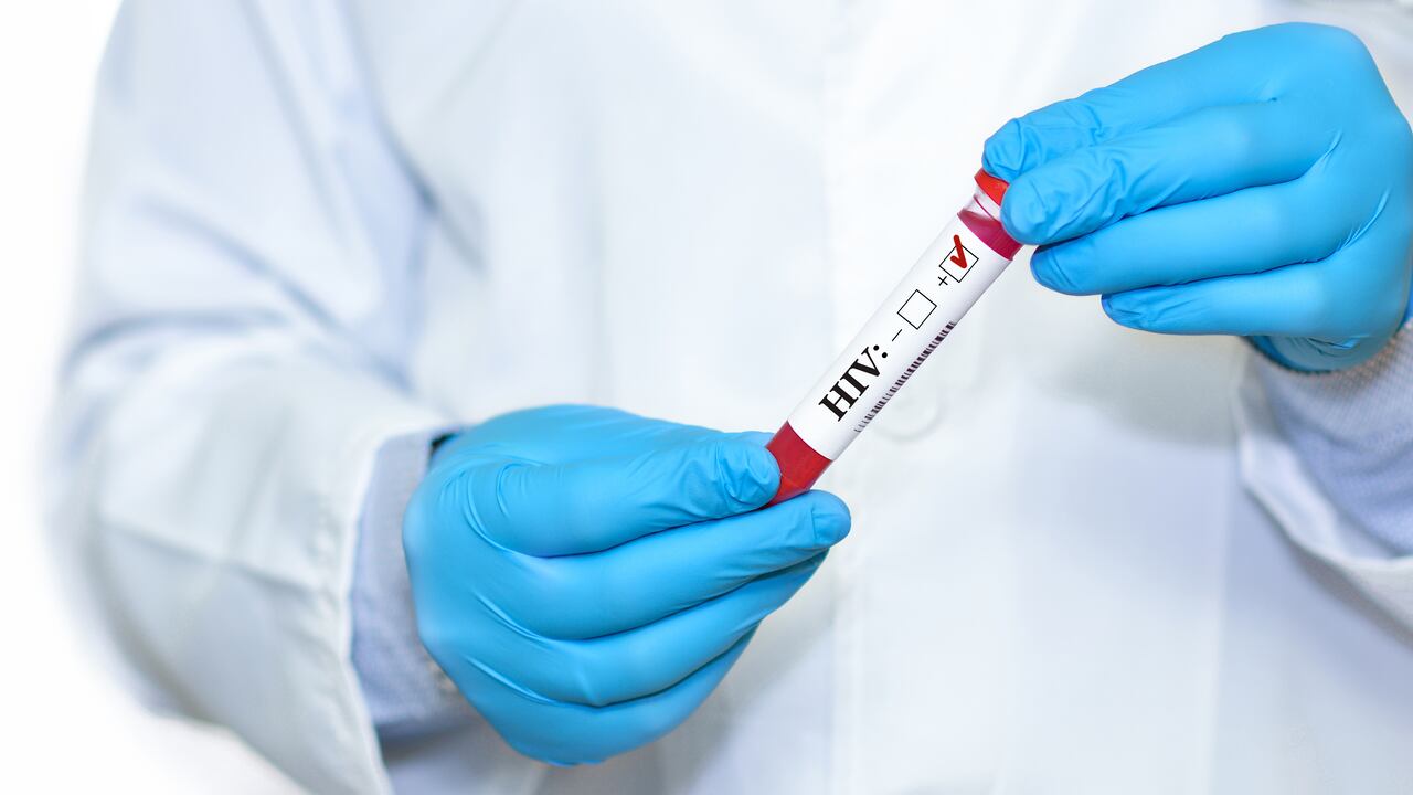 Expertos señalan que la detección temprana del VIH es fundamental, ya que permite iniciar un tratamiento adecuado que no solo ayuda a mantener la salud del individuo, sino que también reduce la posibilidad de transmisión a otras personas.