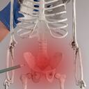 Este es el alimento que se debe tomar cada día para frenar la osteoporosis.